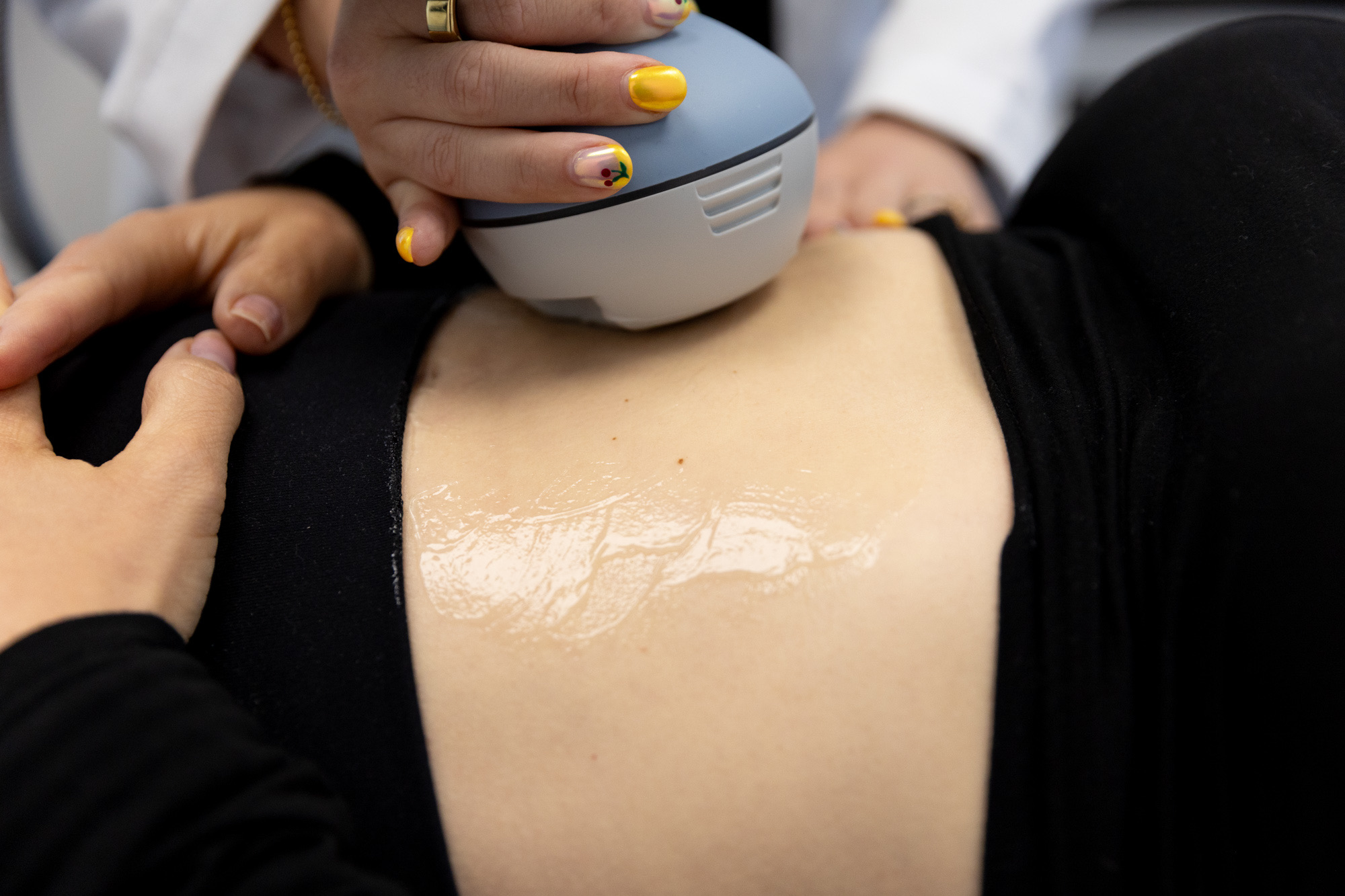Body Fat Reduction