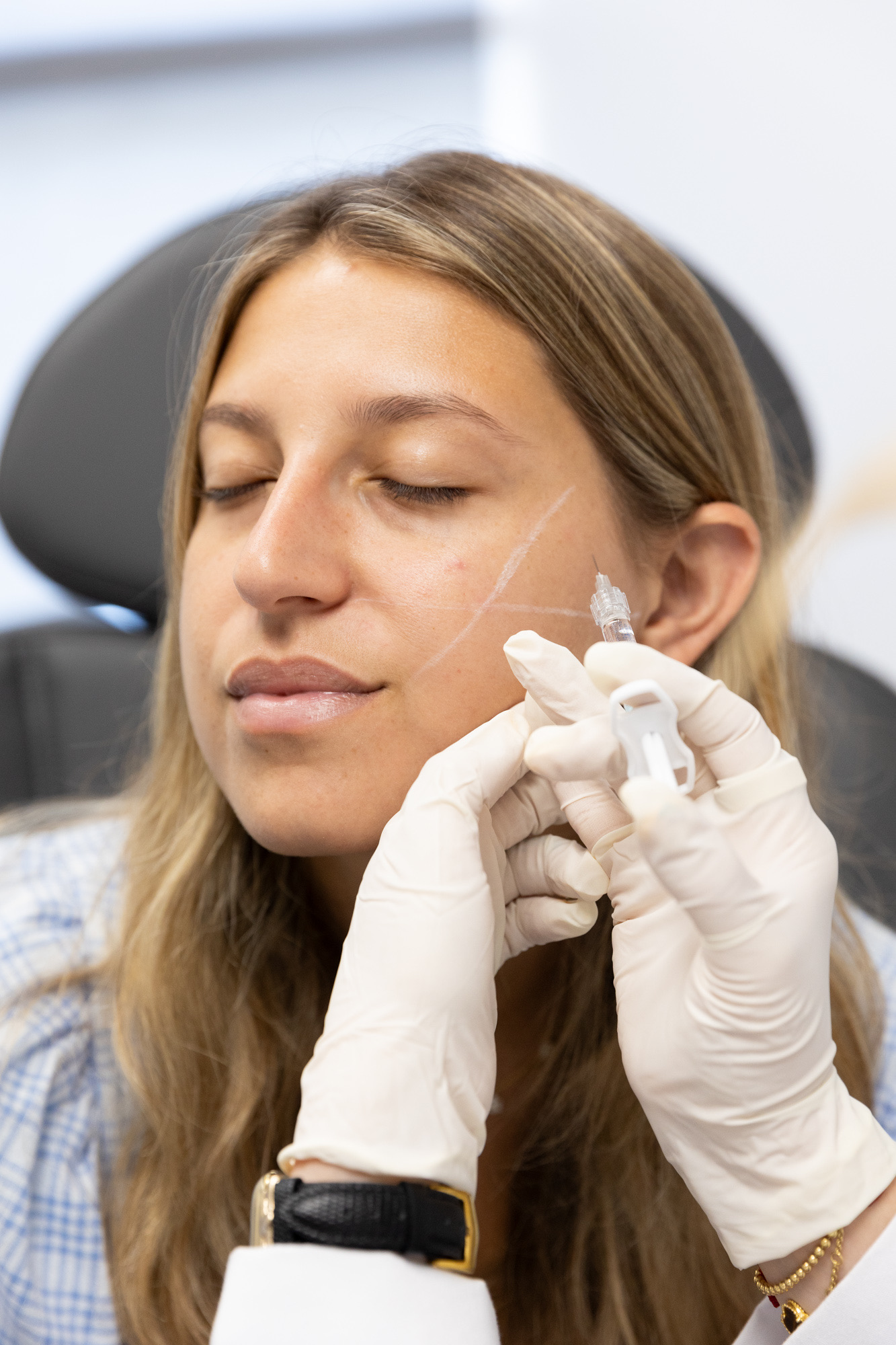 Filler treatment at Form & Function