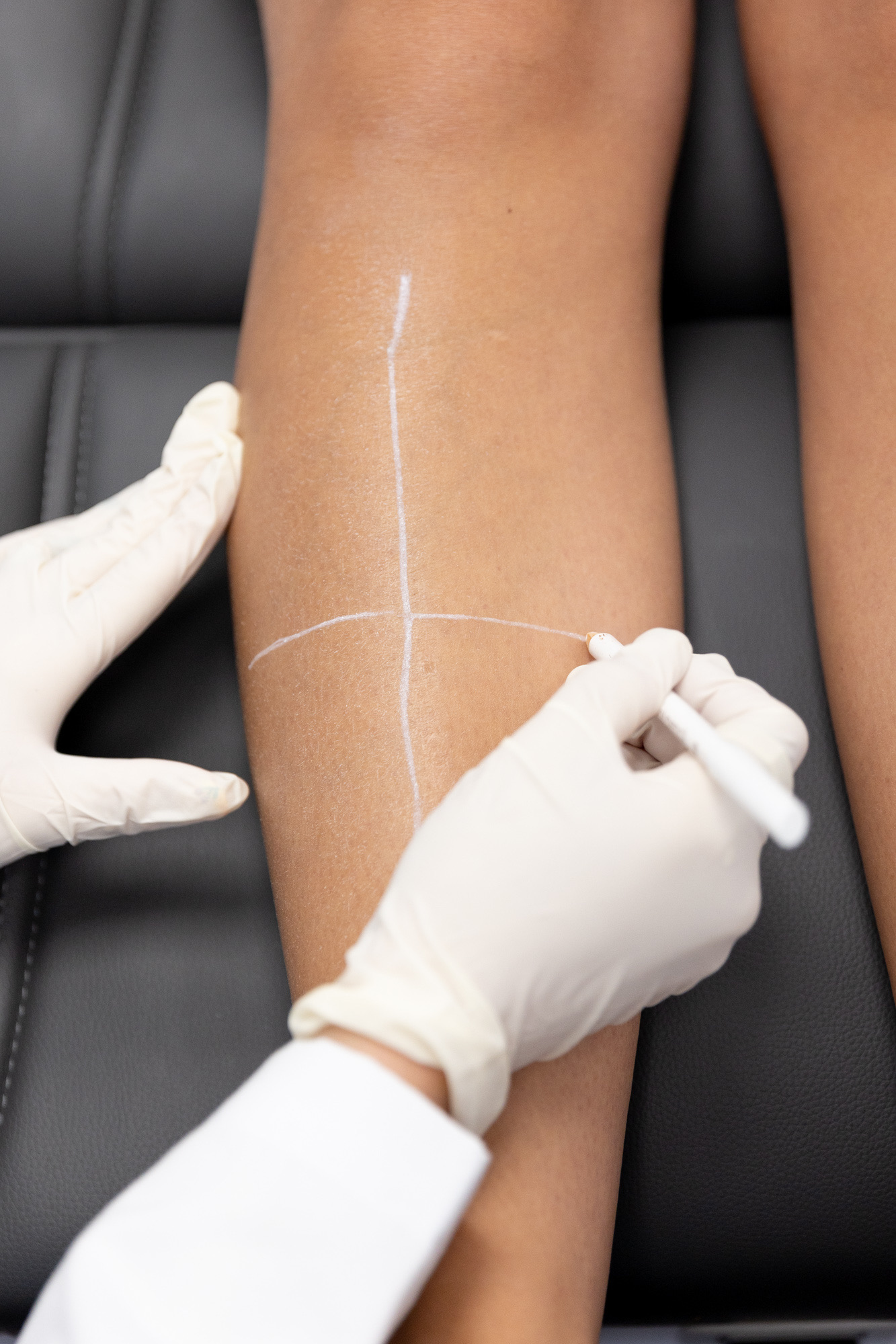 Laser hair removal at Form & Function